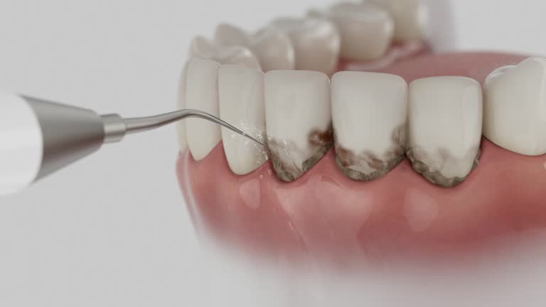 Reliable Dental contractor in Colon, MI by Smile Center Dentistry